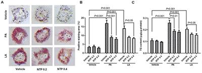 Neurotropin Inhibits Lipid Accumulation by Maintaining Mitochondrial Function in Hepatocytes via AMPK Activation